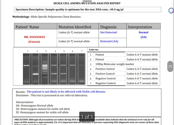 Image of Sickle Cell mutation